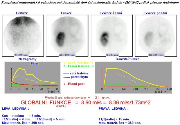 Scinti ledvin dynamická.jpg