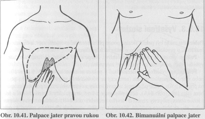 Palpace jater I.jpg