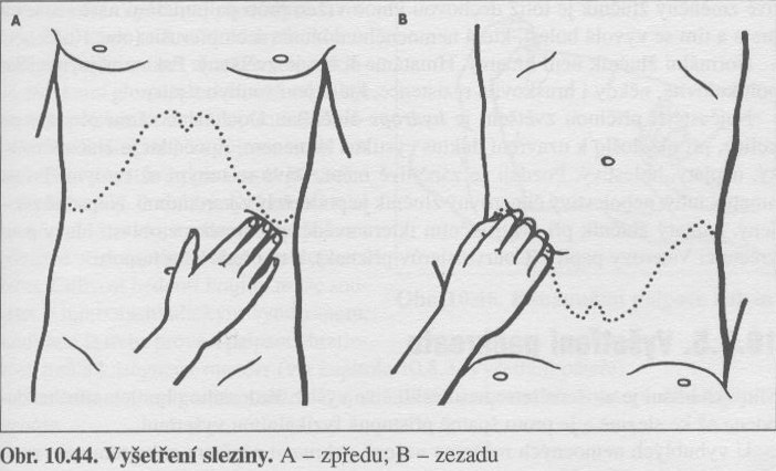 Vyšetření sleziny I.jpg